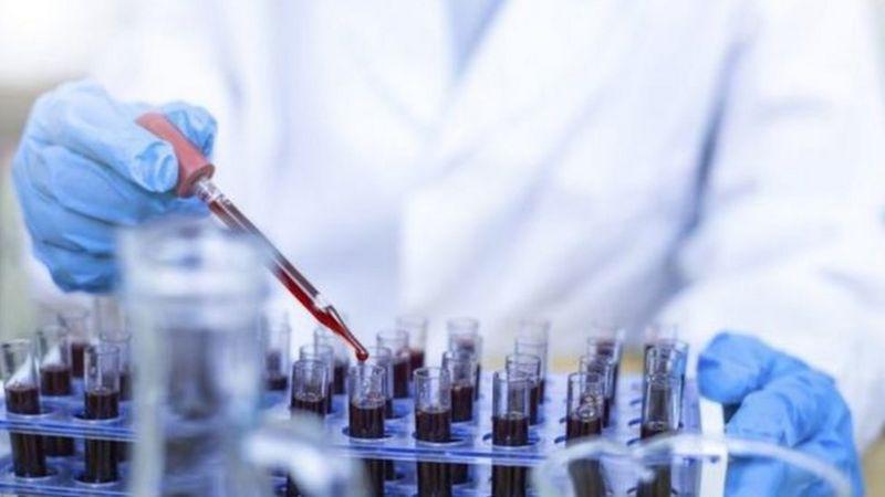 არის თუ არა ეფექტიანი "ფაიზერის“ და "ასტრაზენეკას“ ვაქცინების ორი დოზა კორონავირუსის "დელტა“ შტამის წინააღმდეგ? - რა აჩვენა კვლევამ