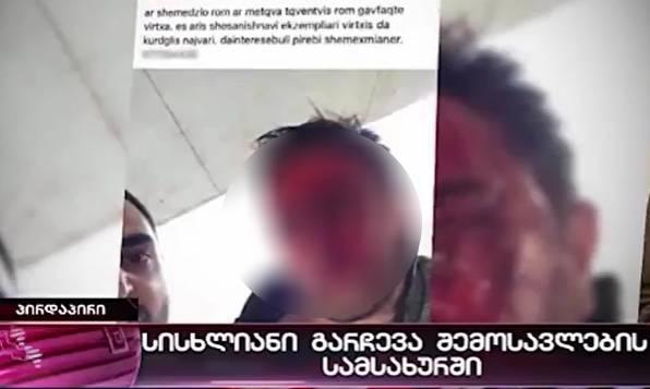 მამაკაცმა ყოფილი თანამშრომელი სასტიკად სცემა და მისი ფოტო "ფეისბუქზე" გამოაქვეყნდა - რა კომენტარს აკეთებს შსს შემოსავლების სამსახურთან მომხდარ დაპირისპირებაზე?