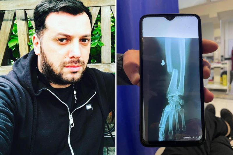 "ეს ჩემი ხელია. ილოცეთ… ტკივილს ვერ ვუძლებ!" - მამა პეტრე კოლხი ავარიაში მოყვა