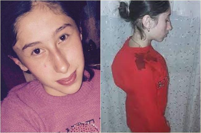 "გთხოვთ, დაგვეხმარეთ ნინის გადარჩენაში" - 16 წლის გოგონას სასწრაფო ოპერაცია სჭირდება, რისთვისაც 17 700 დოლარია საჭირო