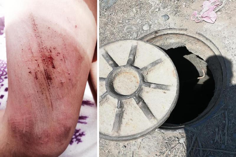 "ყვირილი გავიგონე და არ ჩანდა ბავშვი, მივვარდი ჭას, ახდილი ქონდა თავი და იქვე გავქვავდი..." - რას წერს დედა, რომელსაც 8 წლის შვილი საკანალიზაციო ჭაში ჩაუვარდა