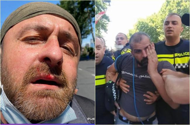 "ასეთი არასდროს არაფერი მომხდარა... დამტვრეულია კამერები. გვაფურთხებდნენ, გვაგინებდნემ" - რას ყვებიან ჟურნალისტები, რომლებსაც მოძალდე პროტესტანტები დაესხნენ თავს