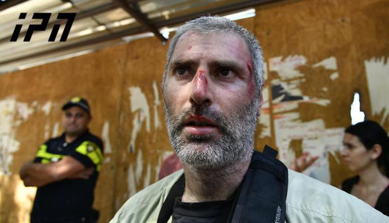 "ფოტოებს ვიღებდი, როცა უკნიდან რაღაც მომხვდა და დავეცი..." - "ინტერპრესნიუსის" ფოტოკორესპონდენტი მომხდარის დეტალებს იხსენებს