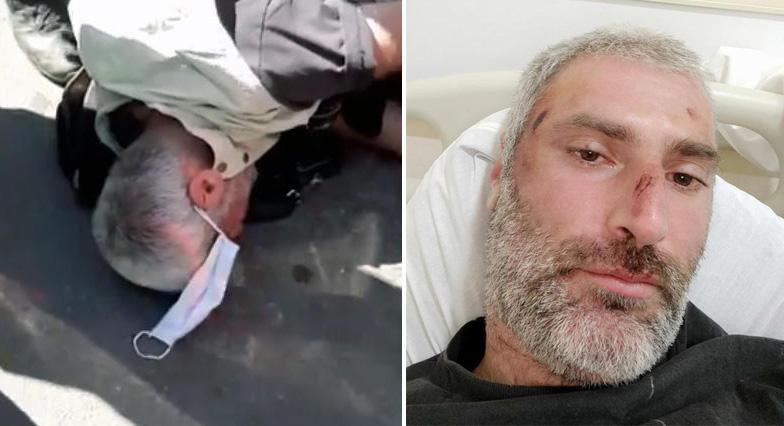 "დაშავებულის დიაგნოზია ტრავმული სუბარაქნოიდული სისხლჩაქცევა, საკმაოდ საყურადღებო მდგომარეობა აქვს" - ექიმი