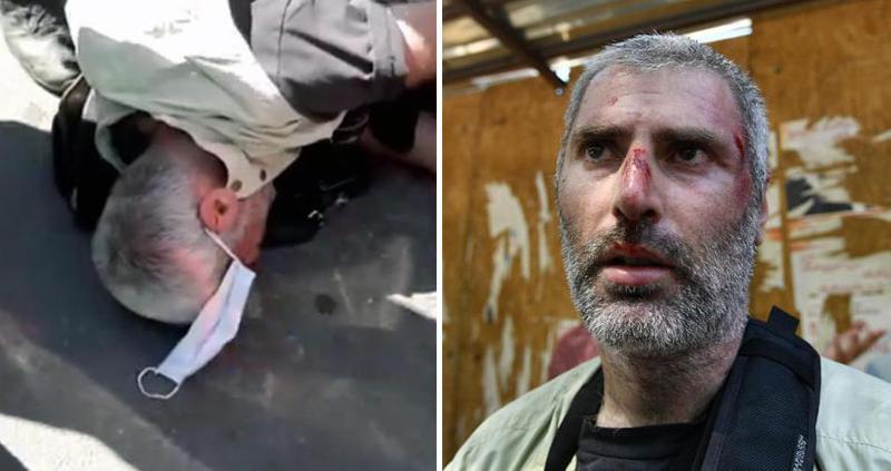 "დაშავებულს დაზიანებები თავის არეში აქვს მიყენებული" - "ინტერპრესნიუსის" ფოტოკორესპონდენტი, რომელსაც თავს დაესხნენ, კლინიკაშია მოთავსებული