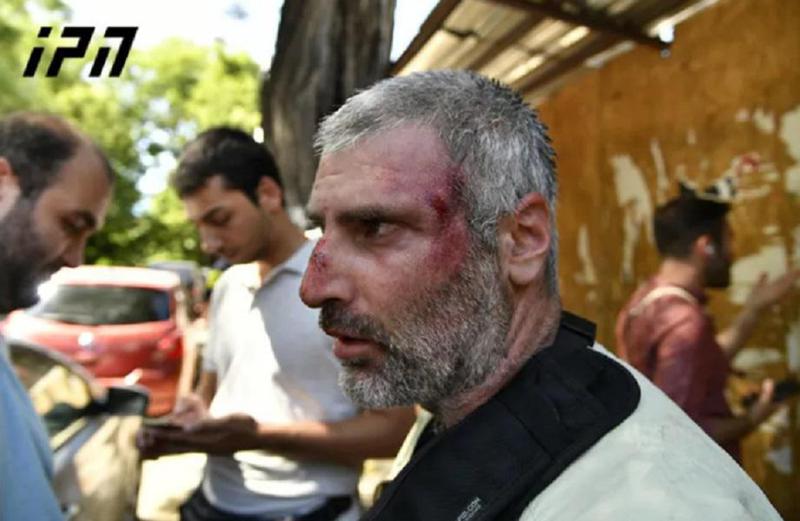 "ღირსების მარშის“ მოწინააღმდეგეები "ინტერპრესნიუსის“ ფოტოკორესპონდენტს ფიზიკურად გაუსწორდნენ