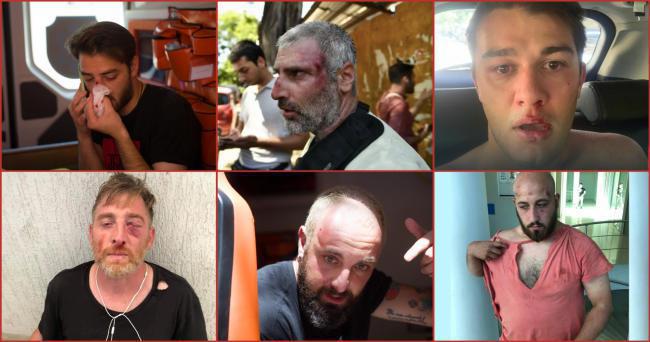 ვინ არიან ჟურნალისტები, ოპერატორები და ფოტოგრაფები, რომლებიც თბილისში დღეს განვითარებული მოვლენებისას დაშავდნენ - სიაში 16 მედიის 47 წარმომადგენელია