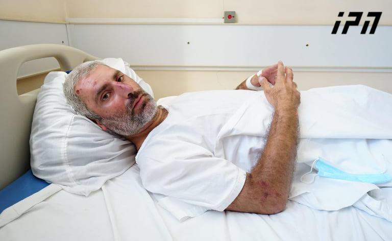 რას ამბობს ექიმი "ინტერპრესნიუსის" ფოტოკორესპონდენტის ჯანმრთელობის მდგომარეობაზე - "იგეგმება განმეორებითი ტომოგრაფია"