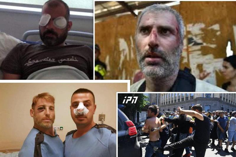 ვინ და რატომ გამოაცხადა ნადირობა მედიაზე - რა არის საერო და სასულიერო ძალაუფლების მქონე ინსტიტუტების და ფაშისტური ჯგუფების მიზანი?