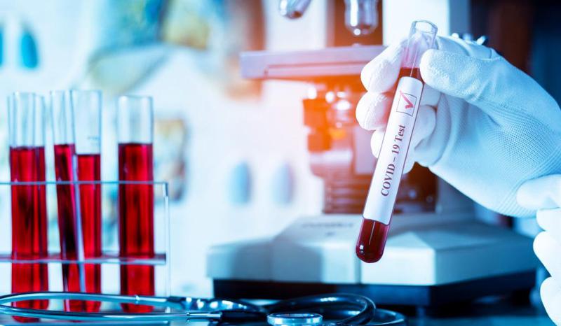 კორონავირუსის 4778 ახალი შემთხვევა და კიდევ 79 გარდაცვლილი - როგორია გასული 24 საათის ეპიდვითარება საქართველოში