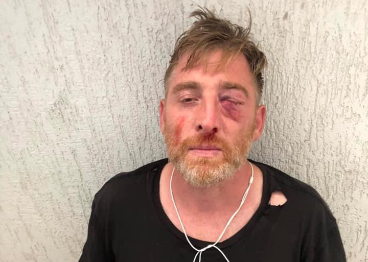 UNESCO-მ მოკლული ჟურნალისტების სიაში "ტვ პირველის“ ოპერატორი ლექსო ლაშქარავა შეიყვანა