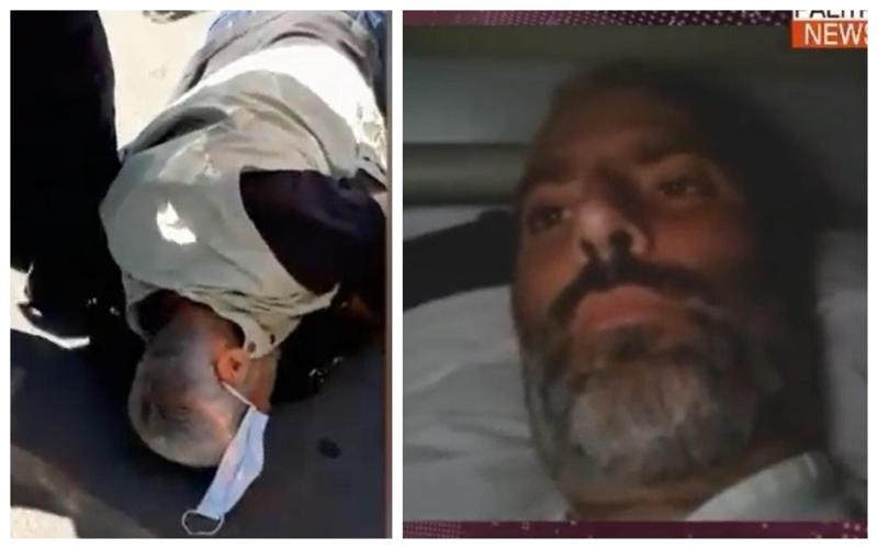 "ტკივილები მაქვს თავის არეში და ჰემატომა ტვინში..." - როგორია "ინტერპრესნიუსის" ფოტოკორესპონდენტის მდგომარეობა, რომელიც 5 ივლისს ძალადობის მსხვერპლი გახდა