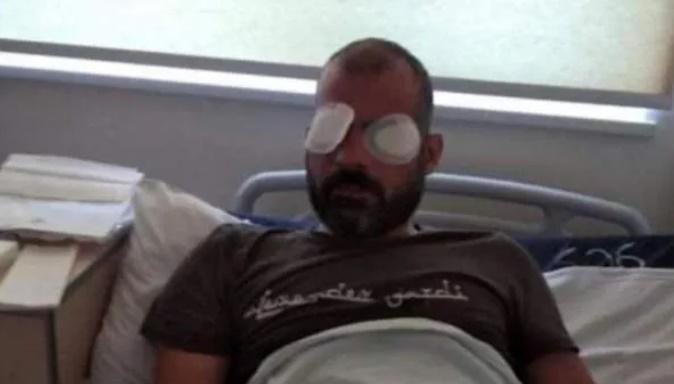 "თავის ტკივილი და თავბრუსხვევა აწუხებდა" - როგორია საზოგადოებრივი მაუწყებლის ოპერატორის მდგომარეობა, რომელსაც 5 ივლისს თავს დაესხნენ