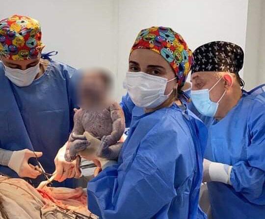 47 წლის კოვიდდადებითი ქალი ტყუპის დედა გახდა - ქალბატონი შვილს 10 წელი ელოდა