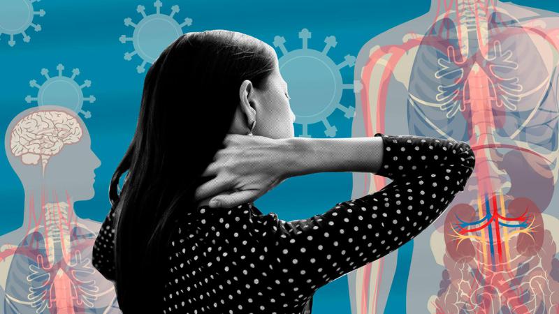 ე.წ. ხანგრძლივი კოვიდი შესაძლოა წელიწადზე მეტ ხანს გაგრძელდეს - რა აჩვენა ახალმა კვლევამ?