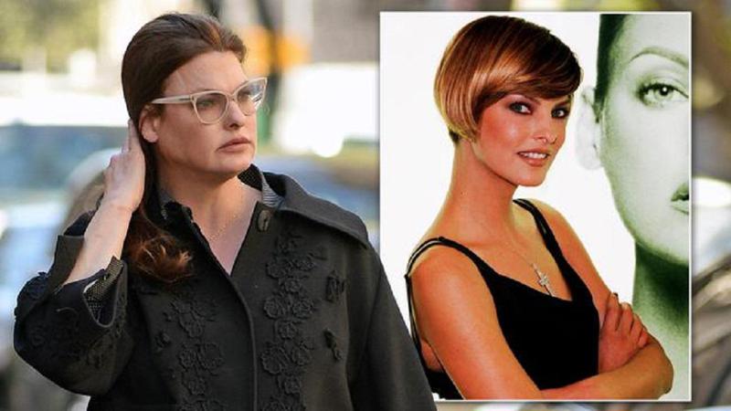 როგორ შეცვალა ლინდა ევანგელისტა "გასახდომმა პროცედურამ" - 90-იანების ულამაზი მოდელის გარდასახვა და მძიმე ცხოვრება: "სასტიკად დამამახინჯეს"