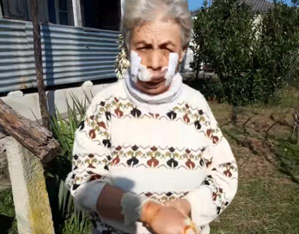 "კარალიოკს ვჭამდი, არ დავკვირვებივარ, ძაღლი მეგონა"- ხონში  ქალს ტურა დაესხა თავს