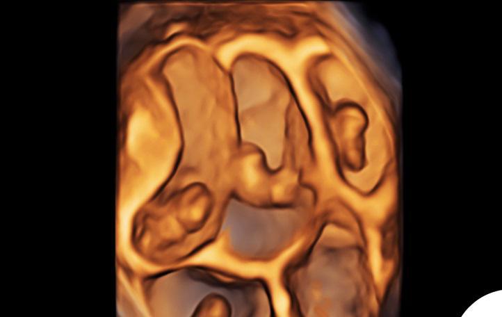 "5-ნაყოფიანი ორსულობა" - დღის ფოტო სოციალური ქსელიდან