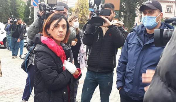 "მონებოს“ დაწერას ვცდილობდი და ამიტომ მომატეხეს თითი“ - ანა წითლიძე