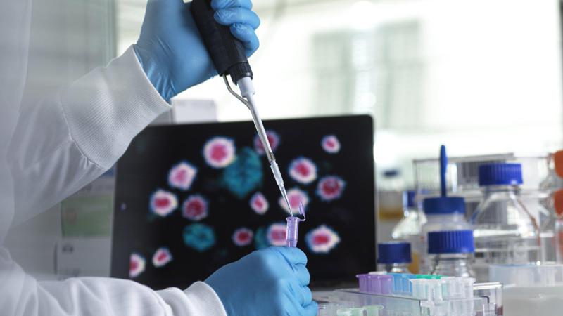 საქართველოში კორონავირუსით ინფიცირების 290 ახალი შემთხვევა გამოვლინდაა, გარდაიცვალა კიდევ 2 პაციენტი - გასული 24 საათის ეპიდვითარება