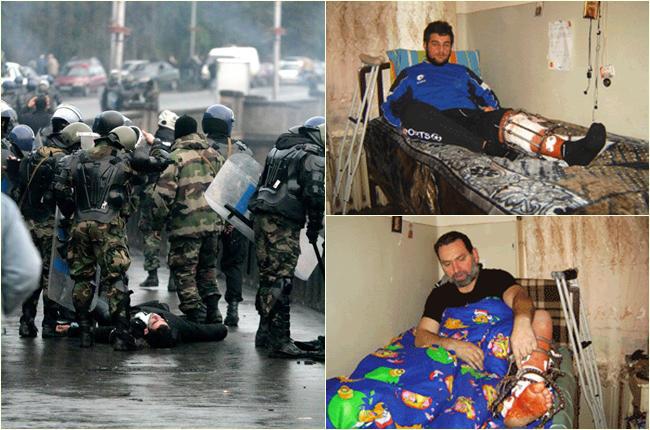 "გამოყენებული იყო აკრძალული იარაღი... დათვებზე სანადირო დუმ-დუმის ტყვიებით დაგვჭრეს" - რას ჰყვება 2007 წლის 7 ნოემბრის აქციის დარბევისას დაშავებული ახალგაზრდა?