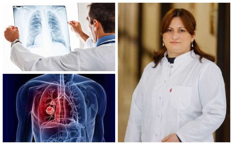 "ეს დაავადება უსიმპტომოდ მიმდინარეობს... როცა ვლინდება, უკვე დაგვიანებულია" - რა იწვევს ფილტვის კიბოს და როგორ ხდება მისი მკურნალობა?