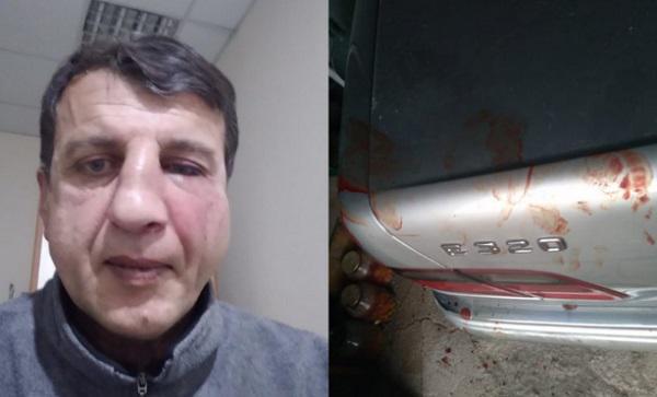 რატომ დაესხნენ თავს "გირჩი - მეტი თავისუფლების" წევრს?