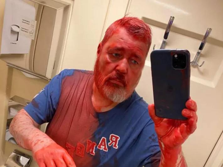 "მურატოვ, აი ეს, ჩვენი ბიჭებისთვისო! ზეთის საღებავში აცეტონი ჩაასხეს, თვალები საშინლად მეწვის" - "ნოვაია გაზეტას" მთავარ რედაქტორს თავს დაესხნენ