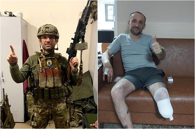 "ჩვენს სამხედრო ექიმებს ჩემთვის ფეხის ამპუტირება "აზოვსტალის" თავშესაფარში მოუწიათ" - რას ჰყვება "აზოვის" პოლკის ქართველი მებრძოლი?