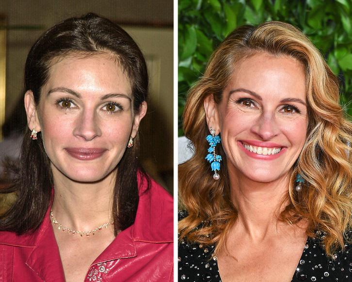 ვარსკვლავები, რომლებმაც ბუნებრივად დაბერება გადაწყვიტეს - ქალები ჰოლივუდიდან, ნაოჭებითა და ჭაღარა თმით