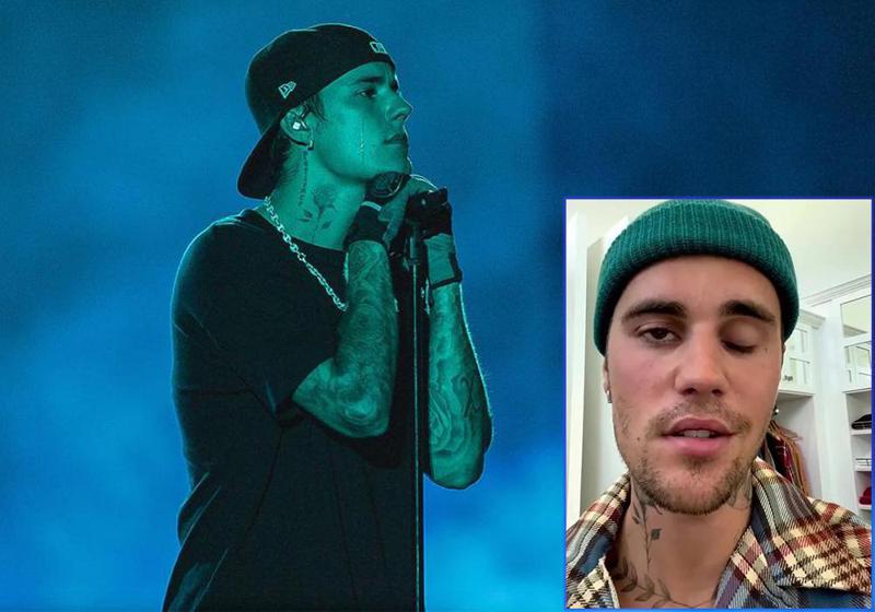 "არ შემიძლია გაღიმება და ვერც მარჯვენა თვალს ვახამხამებ" -  ჯასტინ ბიბერს რამსეი ჰანტის სინდრომი დაუდგინეს: რას წარმოადგენს ეს დაავადება?