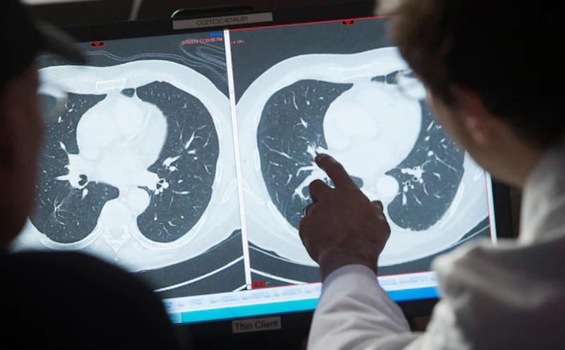 კიბოს წამალი 100%-იანი ეფექტით? - რა ღირს, კონკრეტულად რომელი ტიპის სიმსივნის წინააღმდეგაა მიმართული და არსებობს თუ არა ოპტიმიზმის რეალური საფუძველი