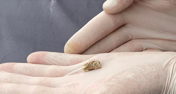 "მსოფლიო მნიშვნელობის, სენსაციური აღმოჩენა" - დმანისში, ოროზმანში არქეოლოგებმა 1,8 მლნ წლის წინანდელი ადამიანის კბილი იპოვეს