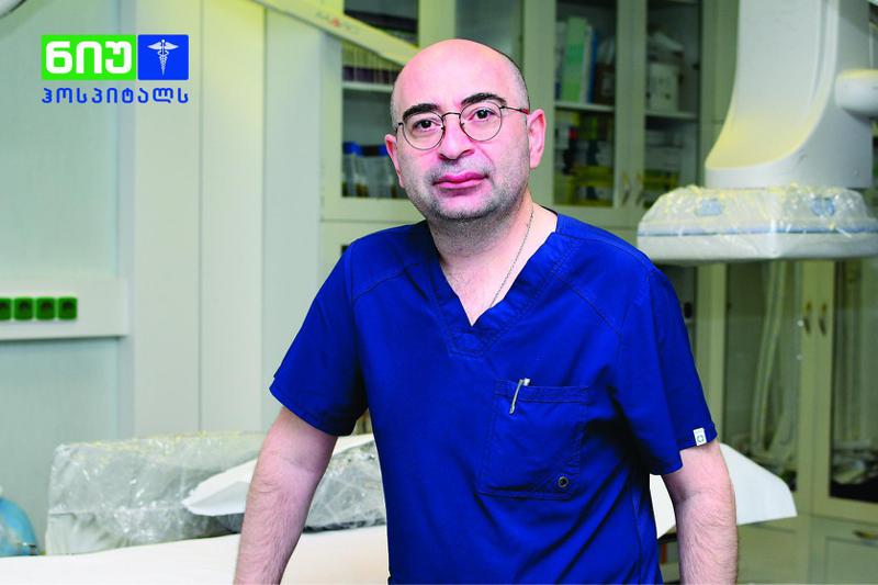 ინსულტის რისკის შესამცირებლად თანამედროვე პროცედურა საქართველოში პირველად ჩატარდა