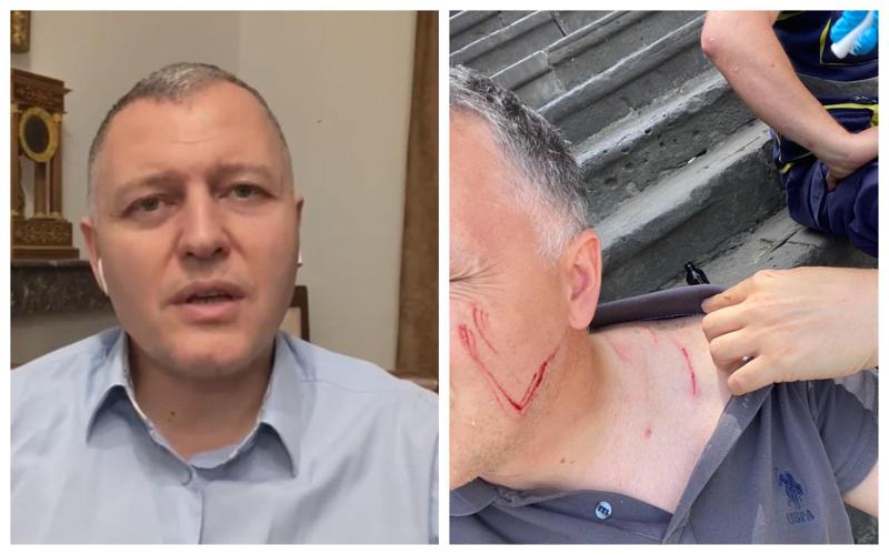 "მე ვარ დაუცველი საქართველოში... მოძალადე ისევ ქუჩაშია" - რას წერს გიორგი ფხაკაძე: ჯანდაცვის ექსპერტი შსს-სა და პროკურატურას მიმართავს