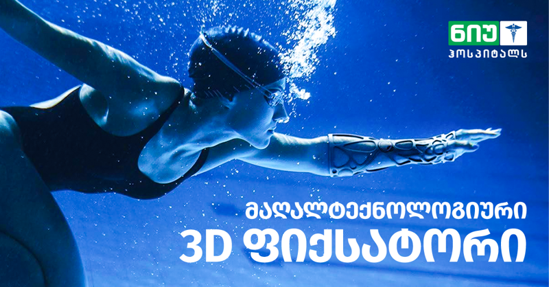 საქართველოში პირველად მაღალტექნოლოგიური 3D ფიქსატორი „ნიუ ჰოსპიტალსშია“