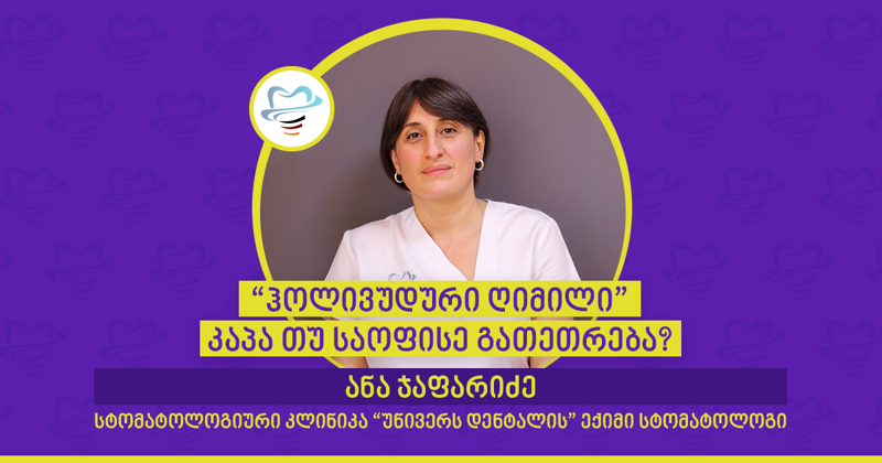 "ჰოლივუდური ღიმილი" - კაპა თუ საოფისე გათეთრება? - სტომატოლოგიური კლინიკა "უნივერს დენტალის" ექიმი სტომატოლოგი ანა ჯაფარიძე