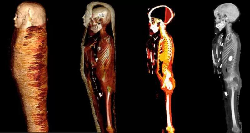 2300 წლის წინანდელი მუმია ოქროს ენით და გულით -  "მკვდრების წიგნის" თანახმად გაპატიოსნებული მოზარდი ბიჭუნას სხეულში 49 ამულეტი იპოვეს