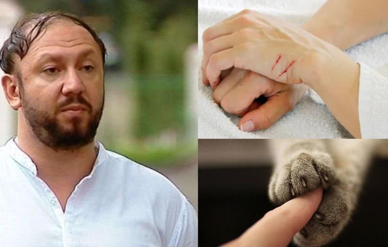 რა არის კატის ნაკაწრის დაავადება, რომელიც საკმაოდ მძიმედ მიმდინარეობს - "მას ბევრი სიმპტომი ახასიათებს... შესაძლოა, ლიმფური კვანძების გადიდება მოხდეს მთელ ორგანიზმში"