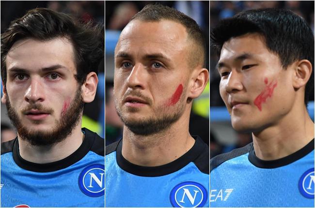 რას ნიშნავს წითელი ზოლი ხვიჩა კვარაცხელიას და მისი თანაგუნდელების სახეზე?