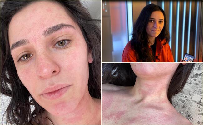 "ასეთ ძალადობას არ ვიმსახურებდით..." - რას ჰყვება თაკო გულბანი, რომელიც აქციაზე მძიმედ მოიწამლა?