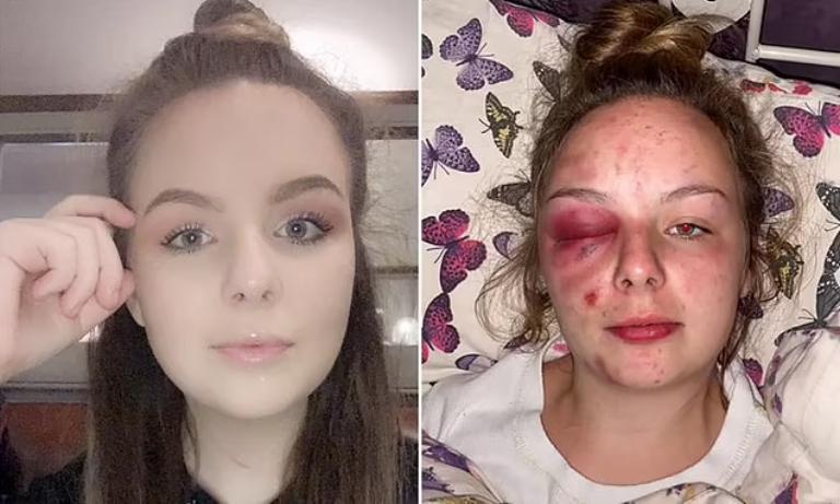 ბრიტანეთში, ქალს, რომელიც გაუპატიურებასა და ძალადობაში 3 მამაკაცს სდებდა ბრალს, ცილისწამებისა და ტყუილისთვის პატიმრობა მიესაჯა - მან მძიმე დაზიანებები თვითონ მიიყენა