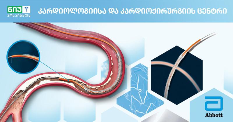 "ნიუ ჰოსპიტალსში“ კორონარული პროცედურები ამერიკული წარმოების სტენტებით ჩატარდება