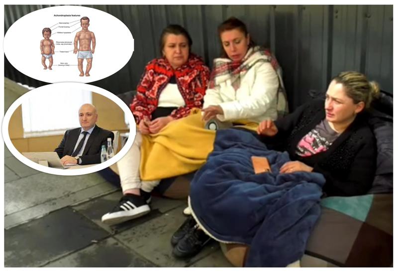 აქონდროპლაზია: იშვიათი დაავადება, რომლის სამკურნალო პრეპარატი რეკორდული ფასი ღირს - თვეებია მშობლები წამლის დაფინანსებას ითხოვენ: როგორია სახელმწიფოს პოზიცია