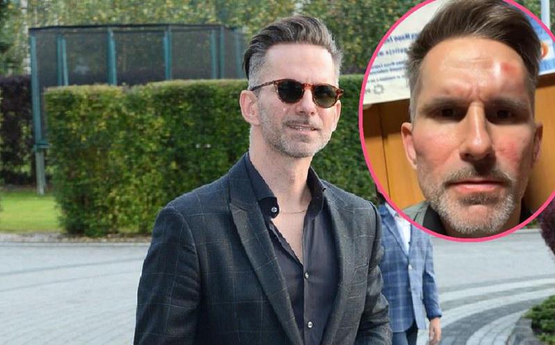 პოლონეთში მსახიობ მარჩინ ბოსაკის ცემის ბრალდებით საქართველოს მოქალაქე დააკავეს - "არასრულწლოვანი შვილის თანდასწრებით ფიზიკურად გაუსწორდა"