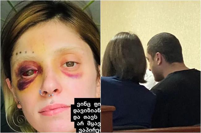 "ვინც ფიქრობს, რომ თავი დავიზიანე, მაგიდა ვირტყი და თავი კედელს ვურტყი..." -  რას წერს რენატა ბეგიაშვილი?