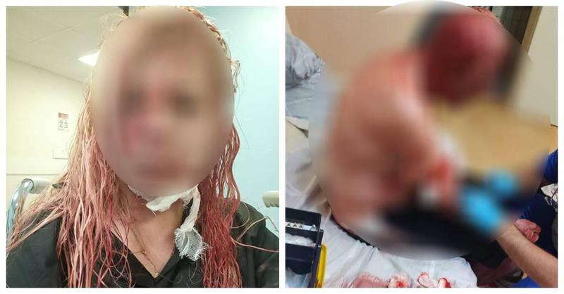 "მამას 30 ჭრილობა აქვს თავზე, ჩემი მოკვლა ყველანაირად სცადა, აბანოში მგუდავდა... ბოლოს სახლს წაუკიდა ცეცხლი" - მოქალაქე წერს, რომ მის ოჯახს თავს მეზობელი დაესხა