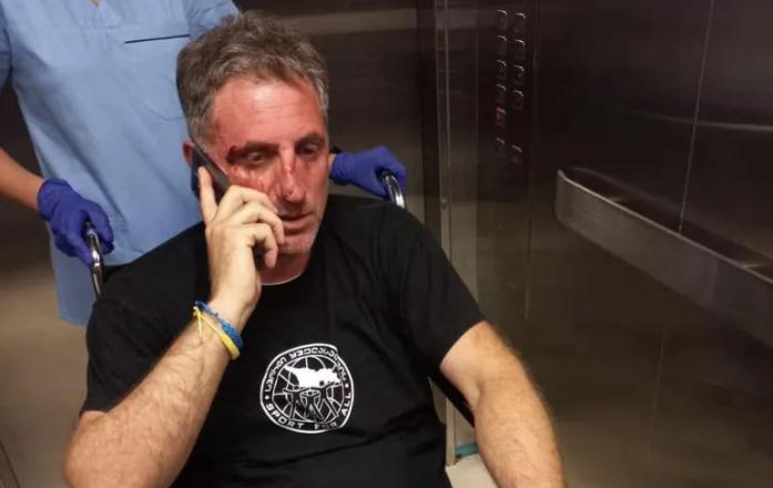 "უმოწყალოდ არის ნაცემი" - ლევან ხაბეიშვილის ინფორმაციით, "ნაცმოძრაობის" სამეურნეო სამსახურის თანამშრომელს თავს დაესხნენ