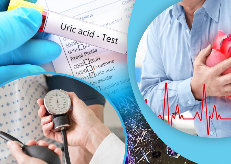 რატომ არის მნიშვნელოვანი შარდმჟავას ანალიზის შემოწმება არტერიული ჰიპერტენზიის დროს?