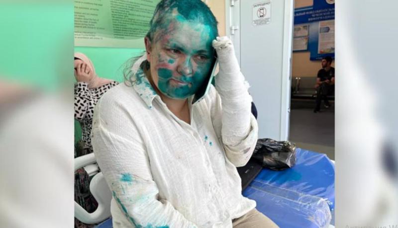 ჩეჩნეთში თავს დაესხნენ ადვოკატს და "ნოვაია გაზეტას" ჟურნალისტს - გზა გადაუჭრეს, სცემდნენ ხელკეტებითა და წიხლებით, ჟურნალისტს გადამტვრეული აქვს თითები